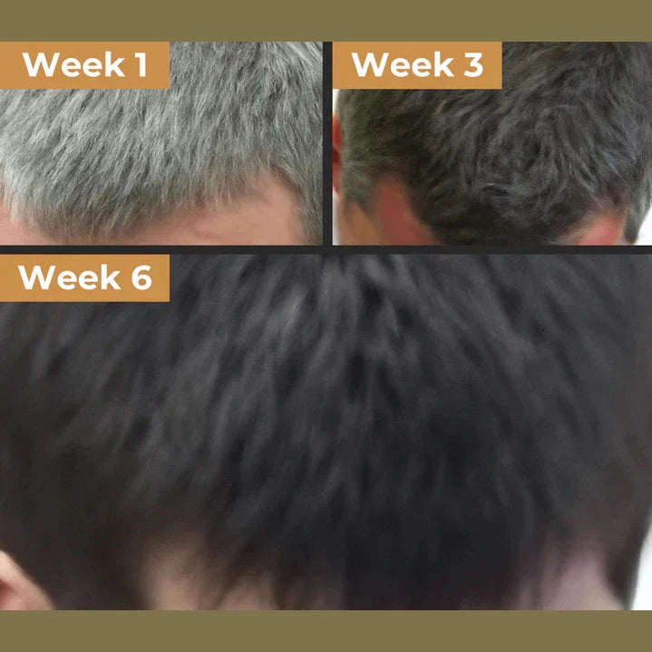 TRATAMIENTO ANTI-CANAS